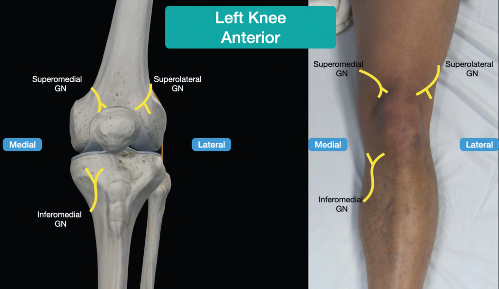 The Ultrasound Guided Genicular Nerve Block ACEP Now