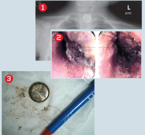 Photos courtesy of Peter Chase, MD, PhD