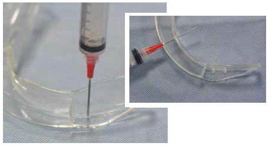 Figure 4. Use the syringe to make three holes in the laryngoscope blade.