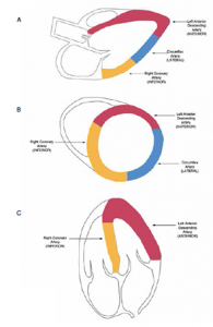 Detect Cardiac Regional Wall Motion Abnormalities by Point-of-Care ...