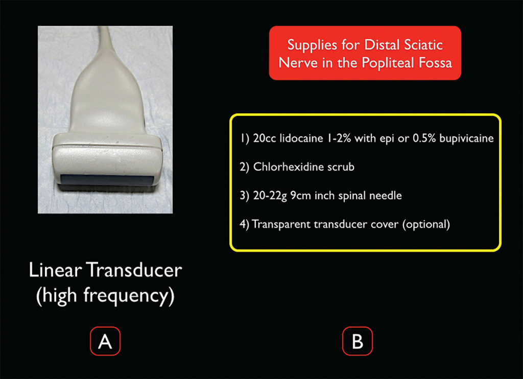 Figure 3. Transducer and supplies needed for ultrasound-guided distal sciatic nerve block in the popliteal fossa.