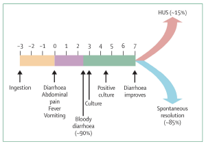 Figure 2: Progression of E. coli 0157 infection in children.