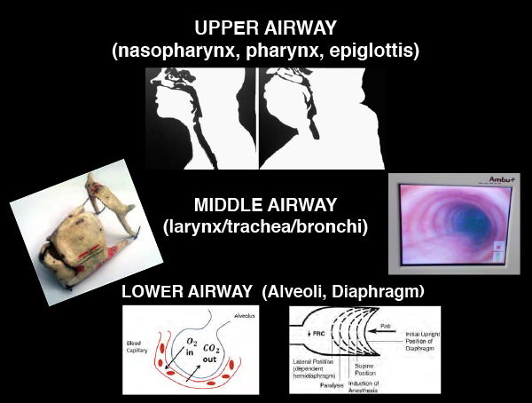 Figure 3: Think of the airway in these three sections.