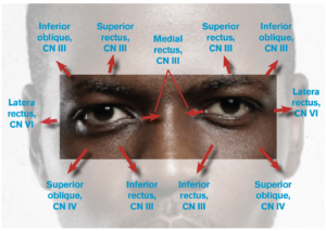 Figure 1: Eye Movements and the Related Cranial Nerves (CNs) and Extraocular Muscles