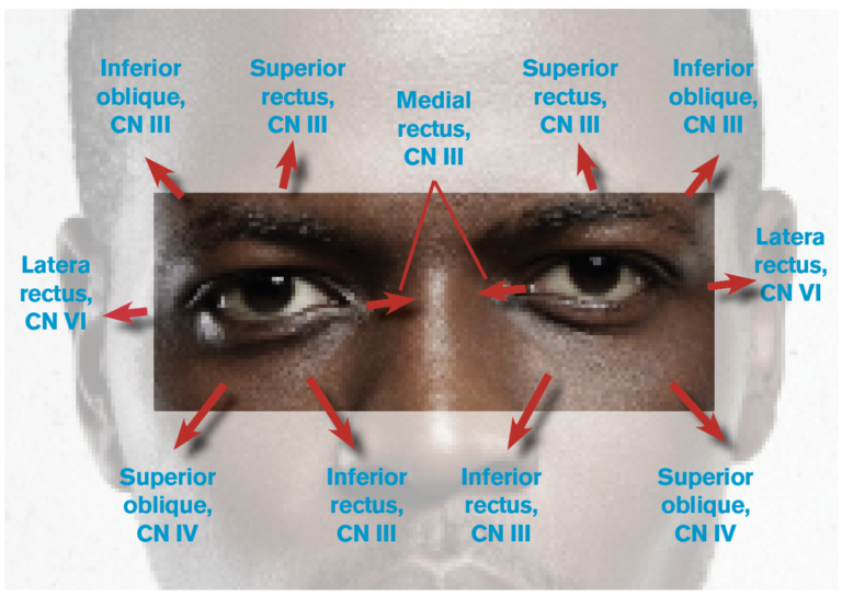 Figure 1: Eye Movements and the Related Cranial Nerves (CNs) and ...